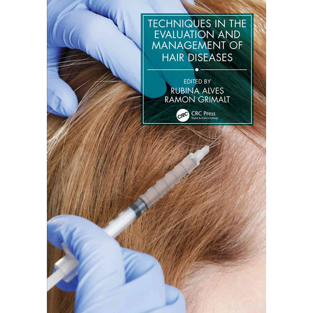 Techniques in the Evaluation and Management of Hair Diseases