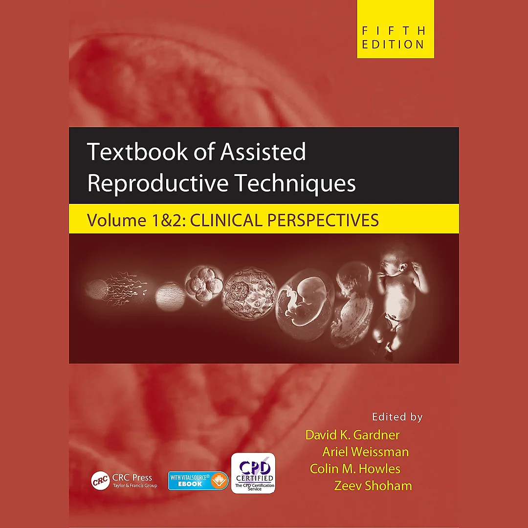 Textbook of Assisted Reproductive Techniques: Two Volume Set