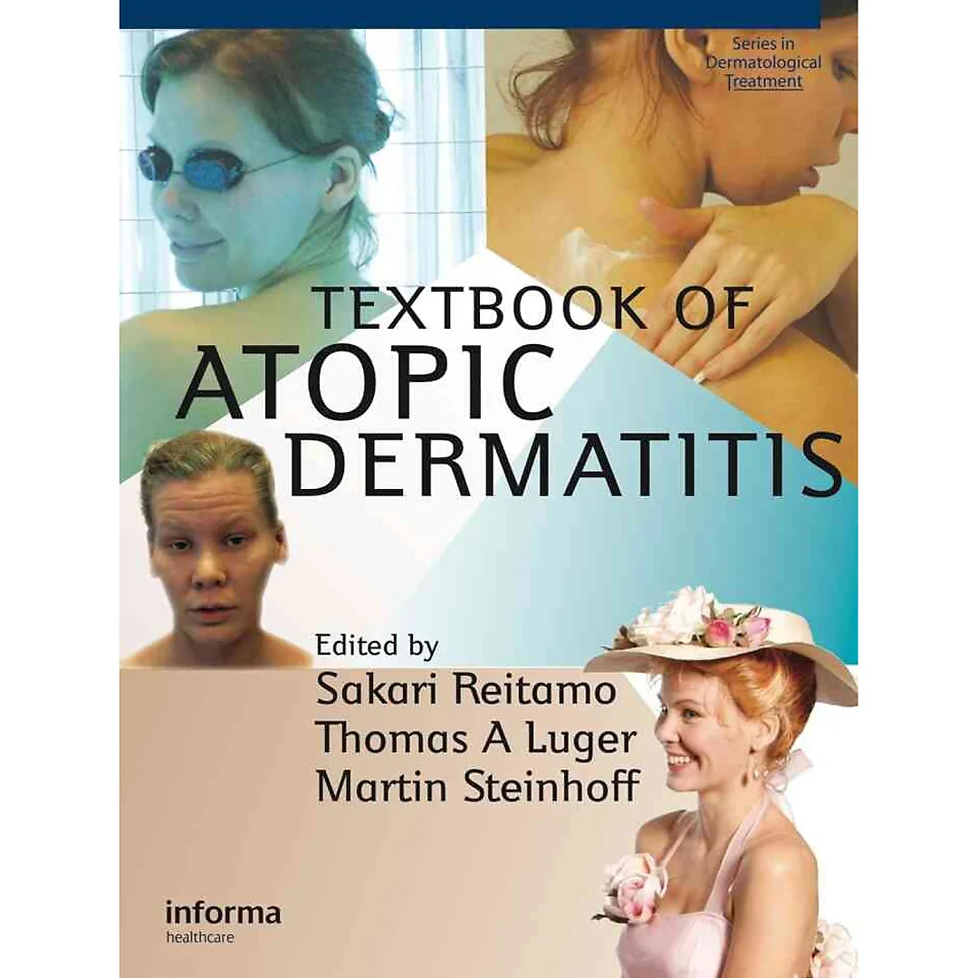 Textbook of Atopic Dermatitis