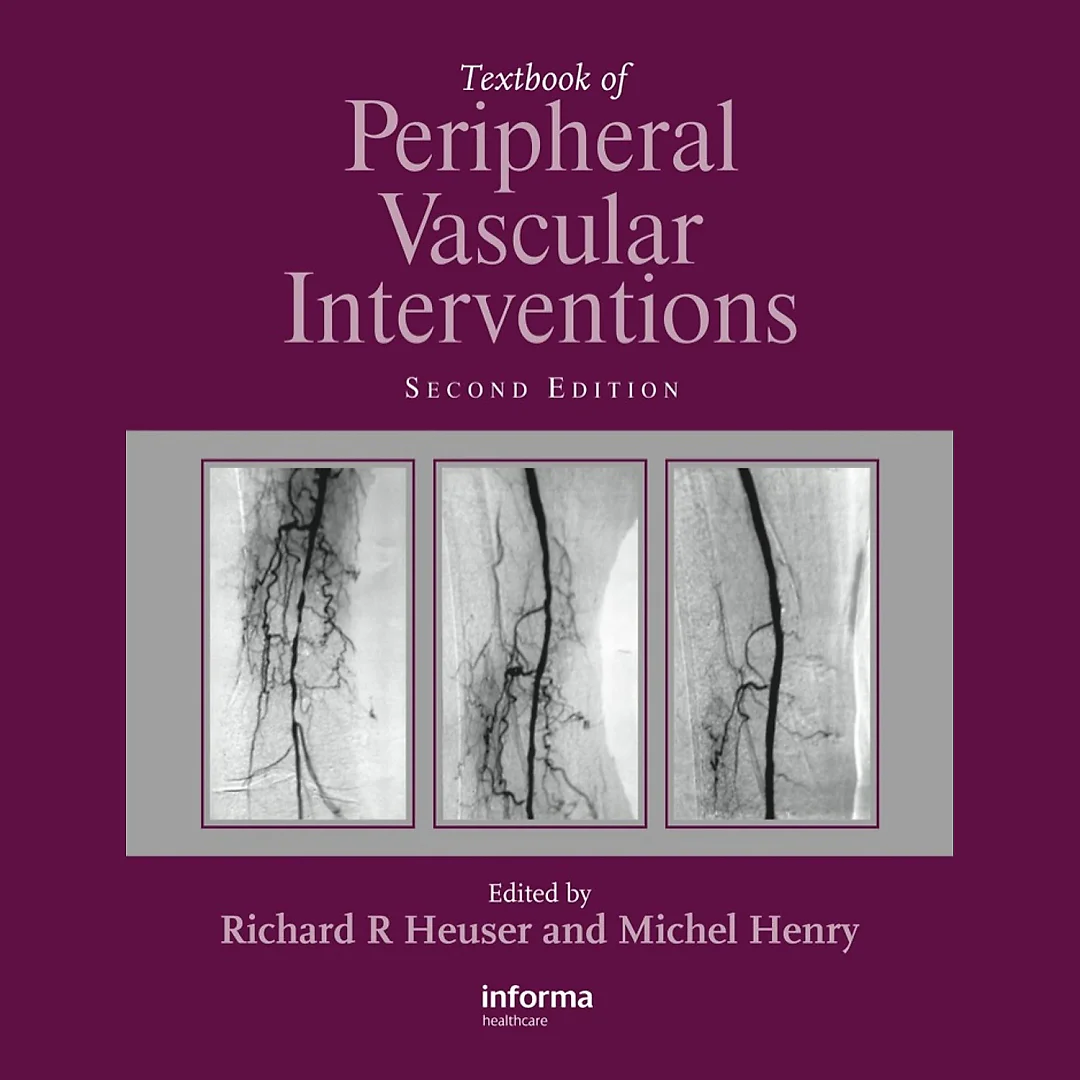 Textbook of Peripheral Vascular Interventions