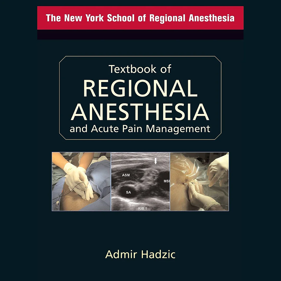 Textbook of Regional Anesthesia and Acute Pain Management