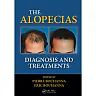 The Alopecias: Diagnosis and Treatments
