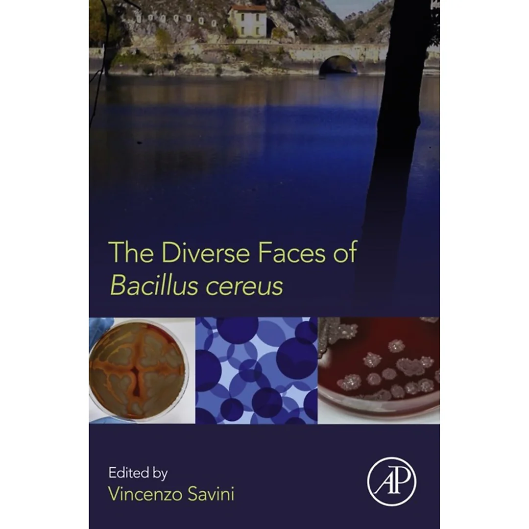 The Diverse Faces of Bacillus Cereus