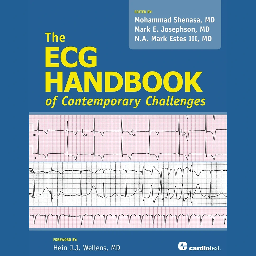 The ECG Handbook of Contemporary Challenges