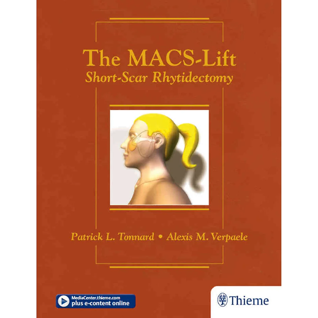 The MACS-Lift: Short-Scar Rhytidectomy