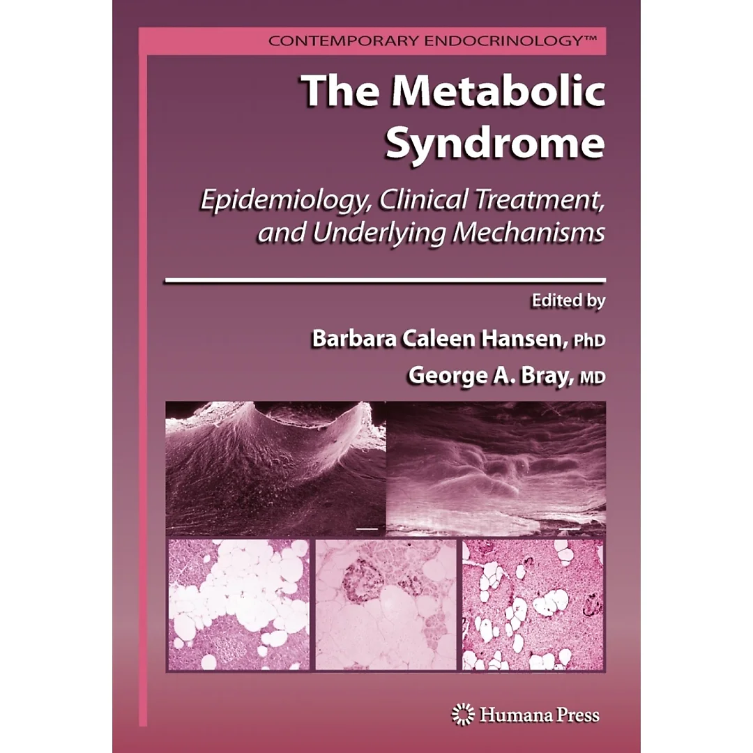 The Metabolic Syndrome: Epidemiology, Clinical Treatment, and Underlying Mechanisms