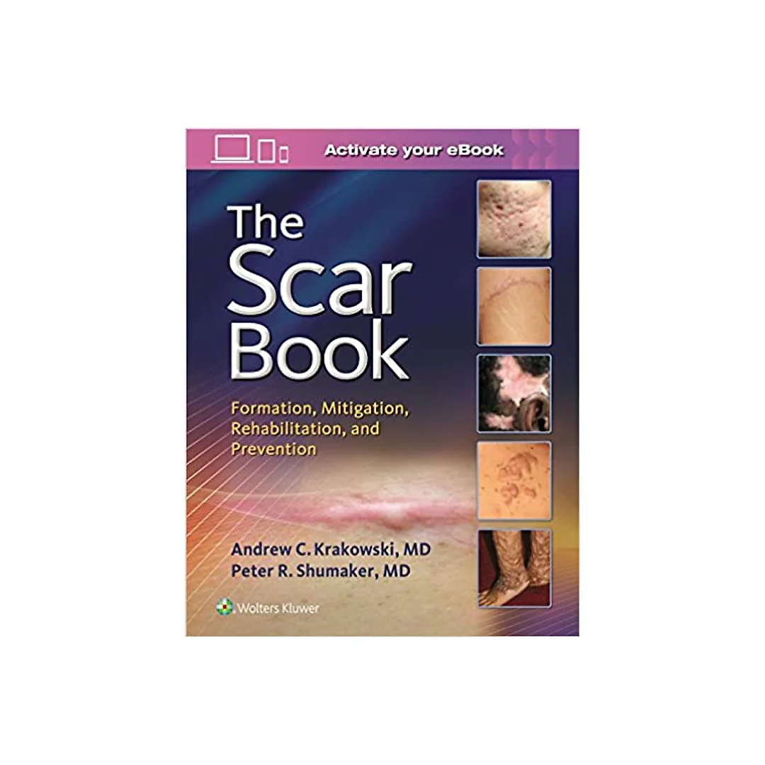 The Scar Book: Formation, Mitigation, Rehabilitation and Prevention
