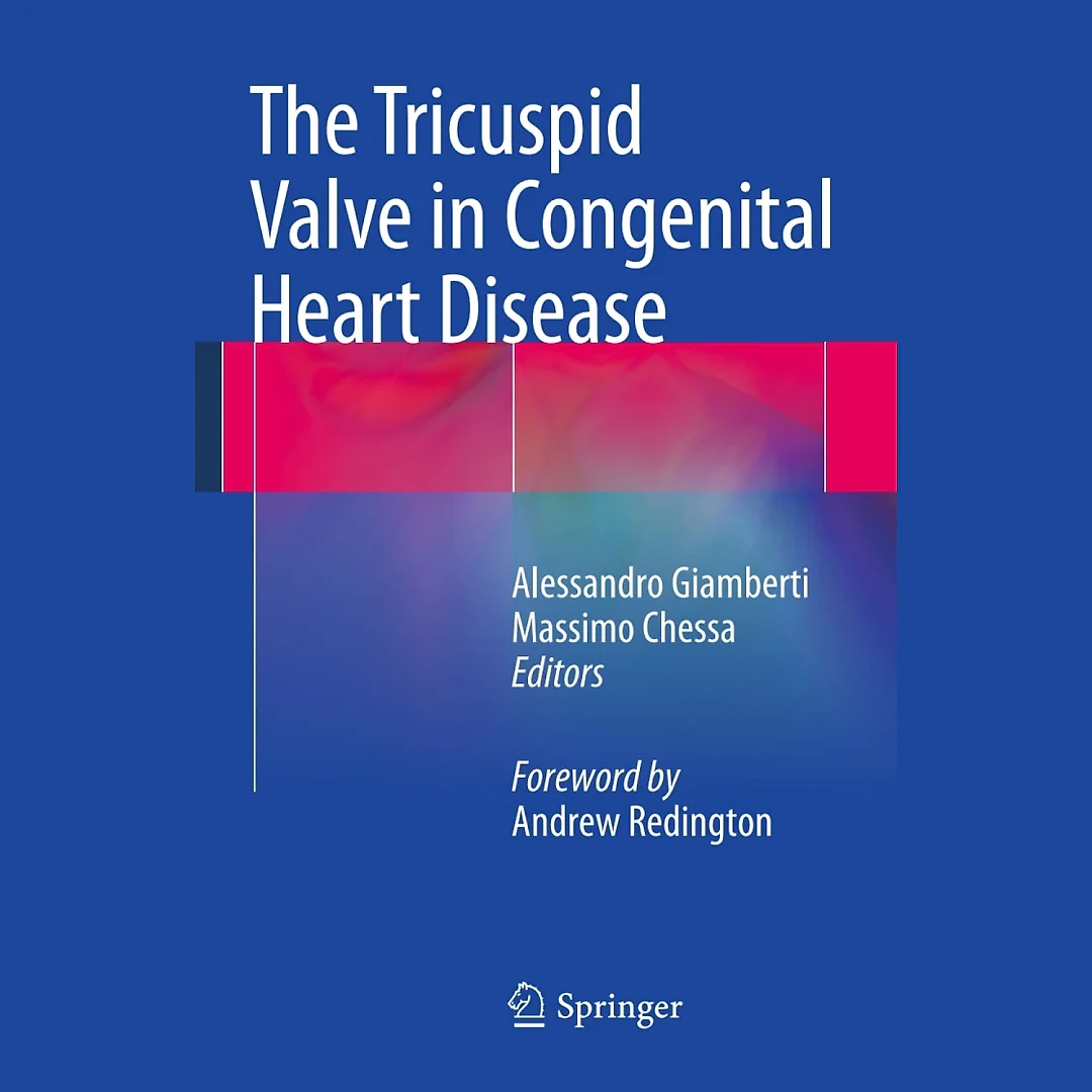 The Tricuspid Valve in Congenital Heart Disease