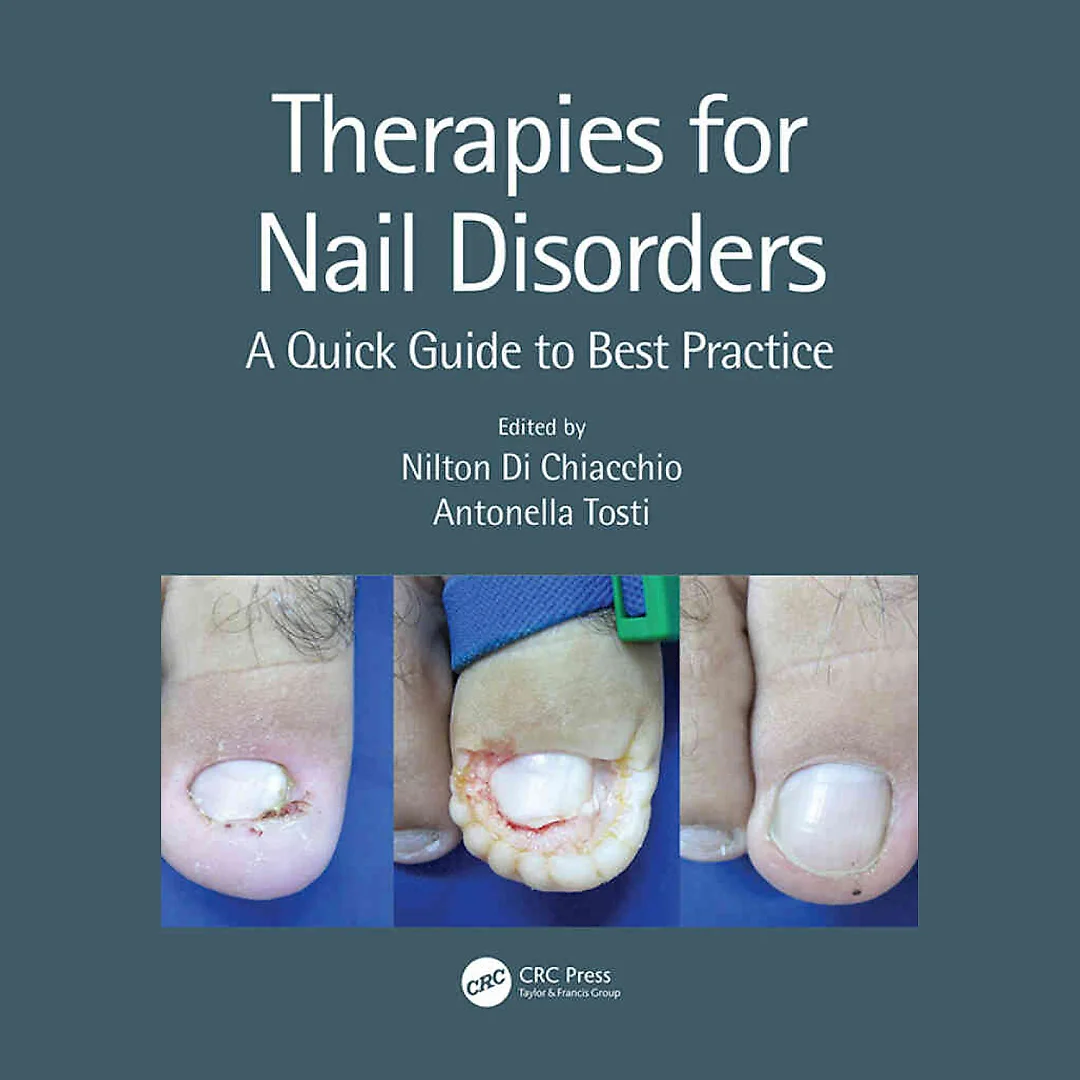 Therapies for Nail Disorders: A Quick Guide to Best Practice