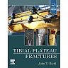 Tibial Plateau Fractures - E-Book