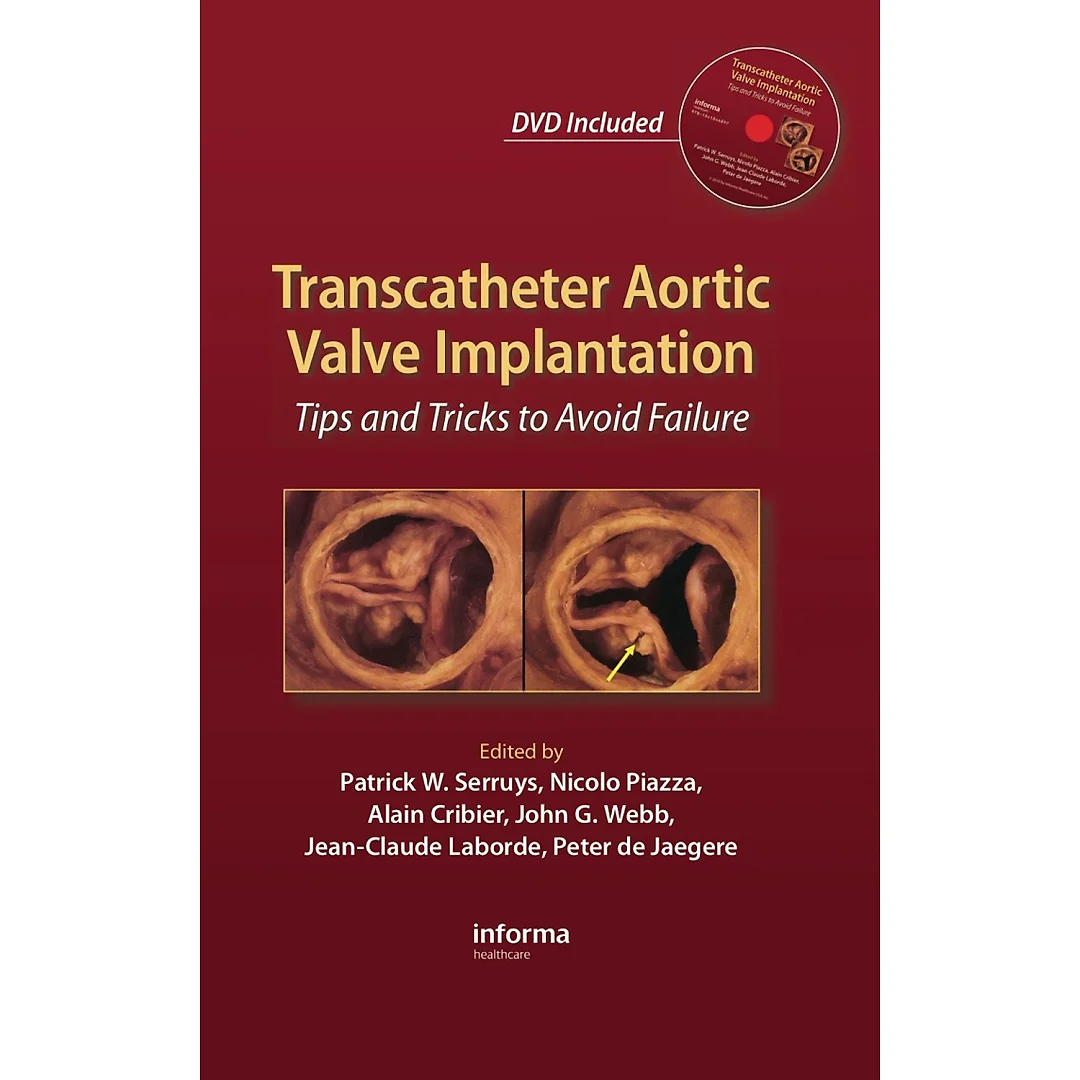 Transcatheter Aortic Valve Implantation: Tips and Tricks to Avoid Failure