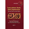 Transcatheter Aortic Valve Implantation: Tips and Tricks to Avoid Failure
