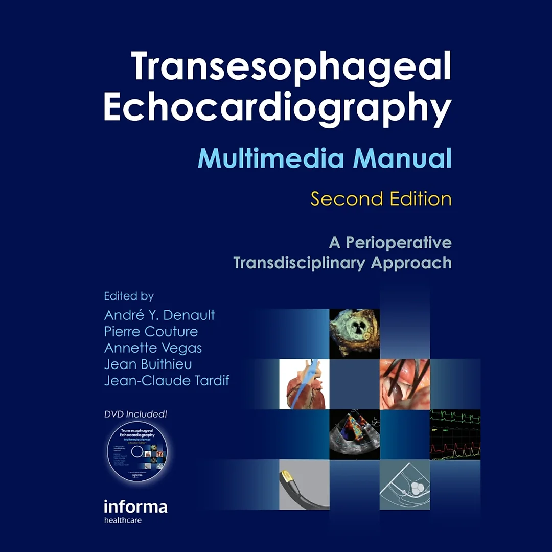 Transesophageal Echocardiography Multimedia Manual: A Perioperative Transdisciplinary Approach