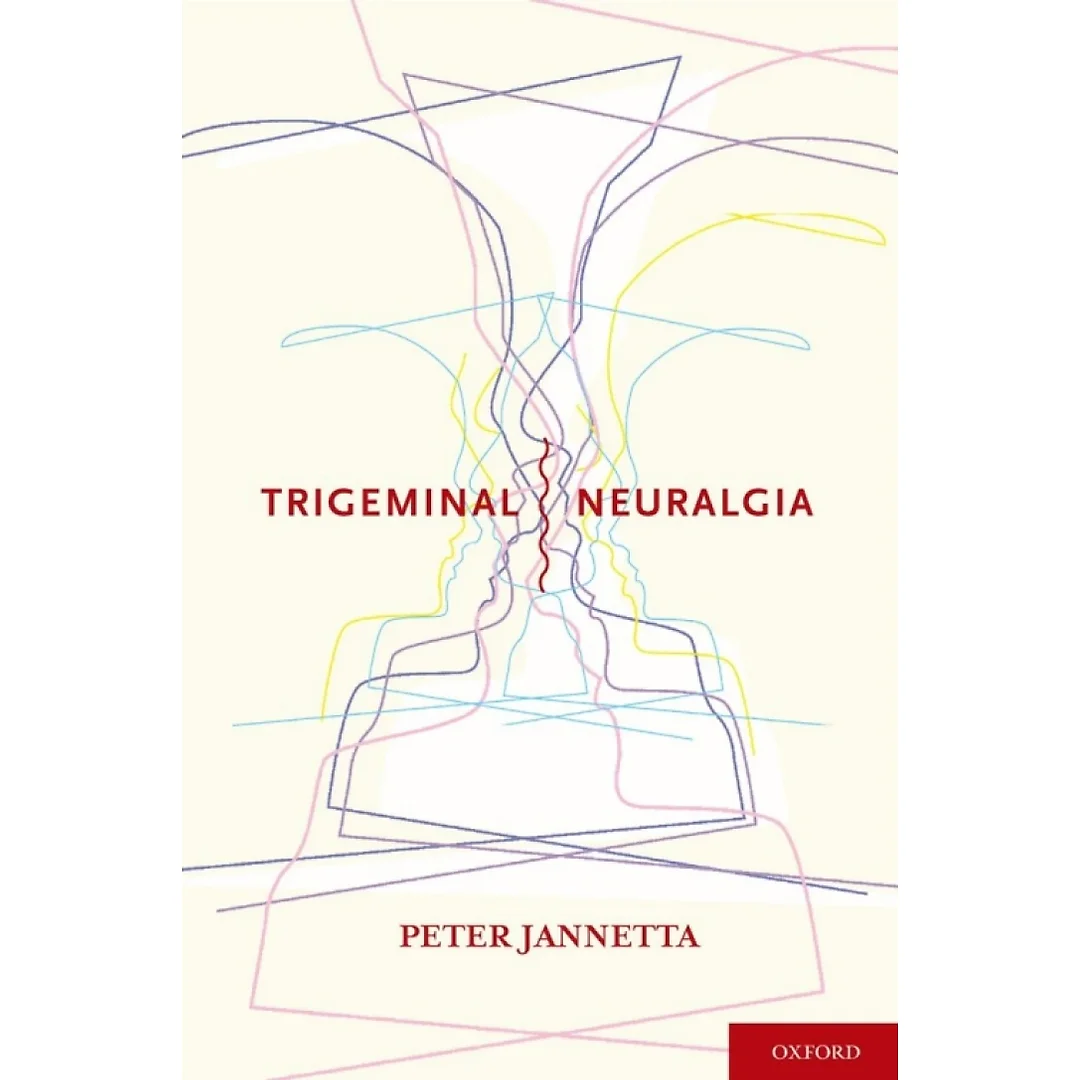 Trigeminal Neuralgia