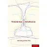 Trigeminal Neuralgia