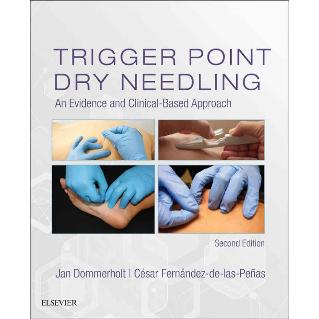 Trigger Point Dry Needling: An Evidence and Clinical-Based Approach, 2nd Edition