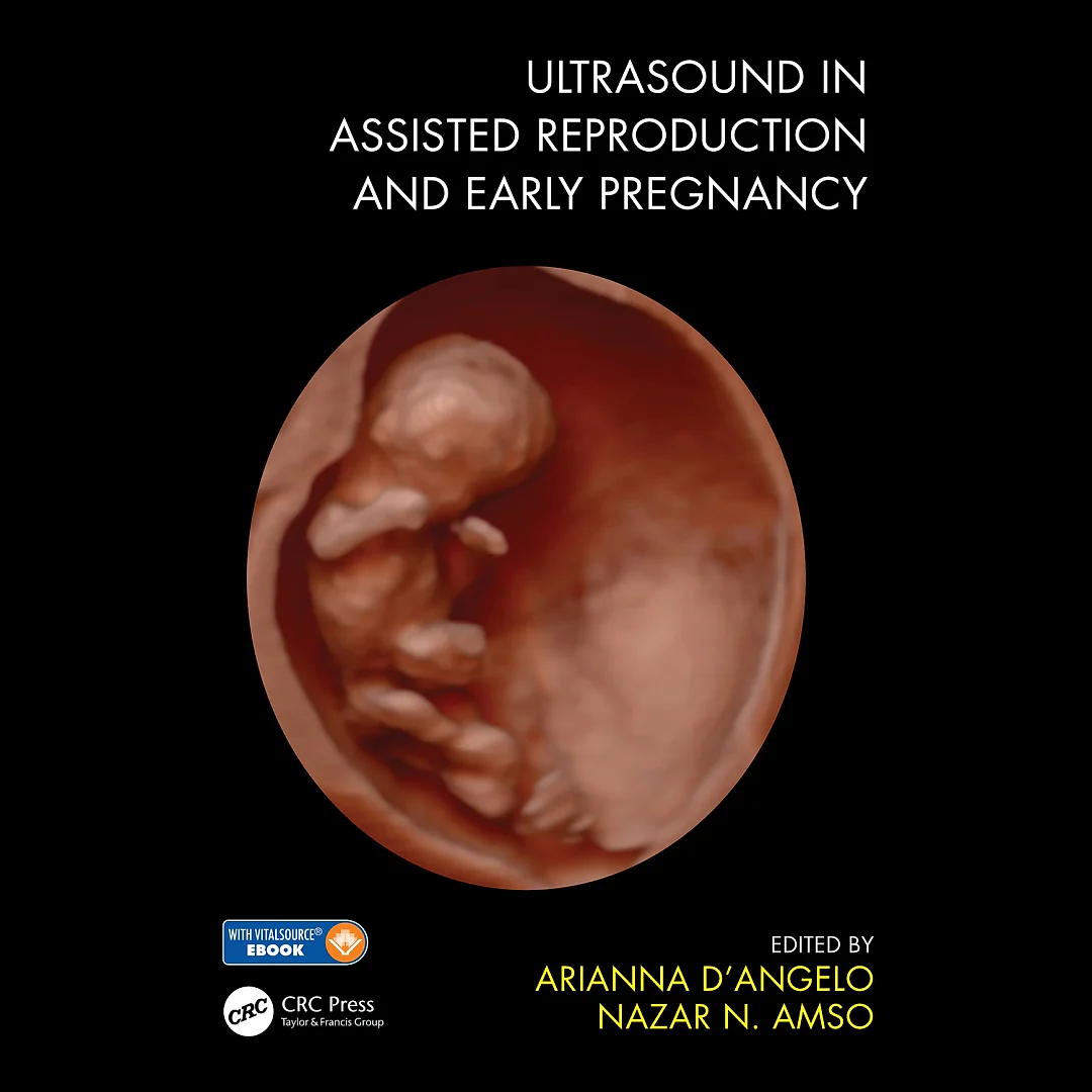 Ultrasound in Assisted Reproduction and Early Pregnancy