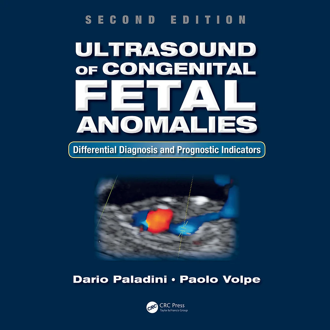 Ultrasound of Congenital Fetal Anomalies: Differential Diagnosis and Prognostic Indicators, Second Edition