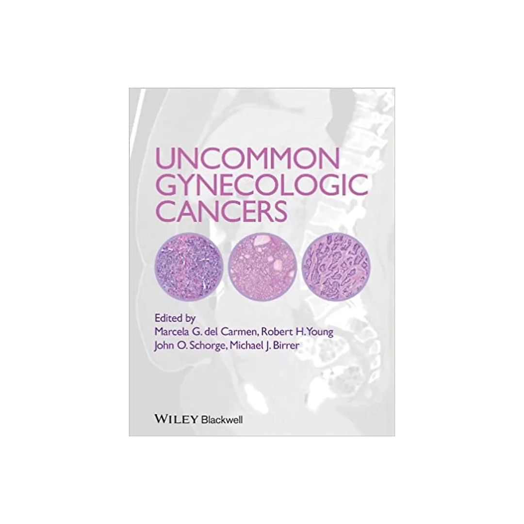 Uncommon Gynecologic Cancers