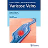 Varicose Veins: Practical Guides in Interventional Radiology