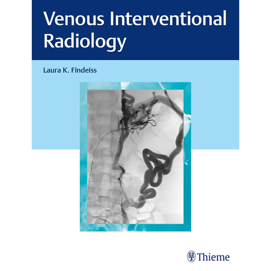 Venous Interventional Radiology