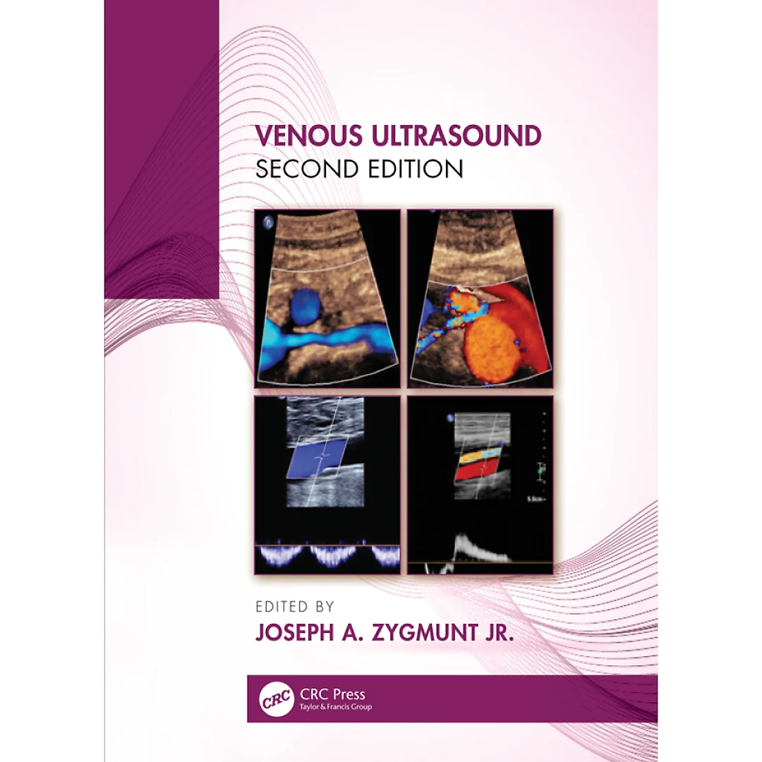 Venous Ultrasound