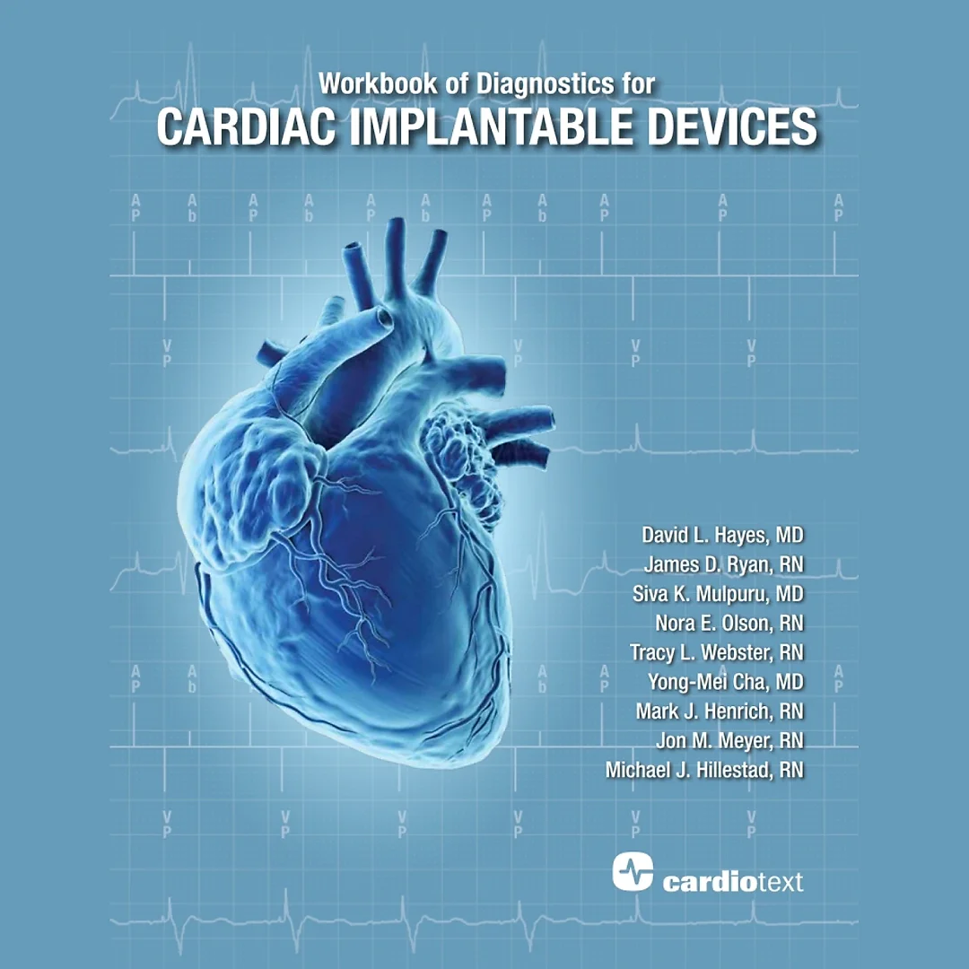 Workbook of Diagnostics for Cardiac Implantable Devices